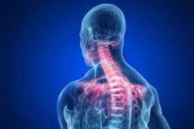CERVICALGIA