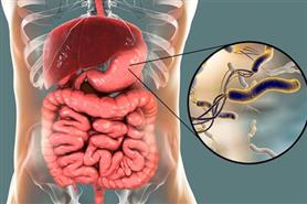 L'infezione da Helicobacter Pylori