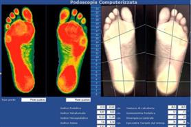 Podologia realizzazione plantari su misura